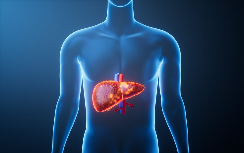 Fatty Liver Disease: Symptoms, Causes & Treatment Guide