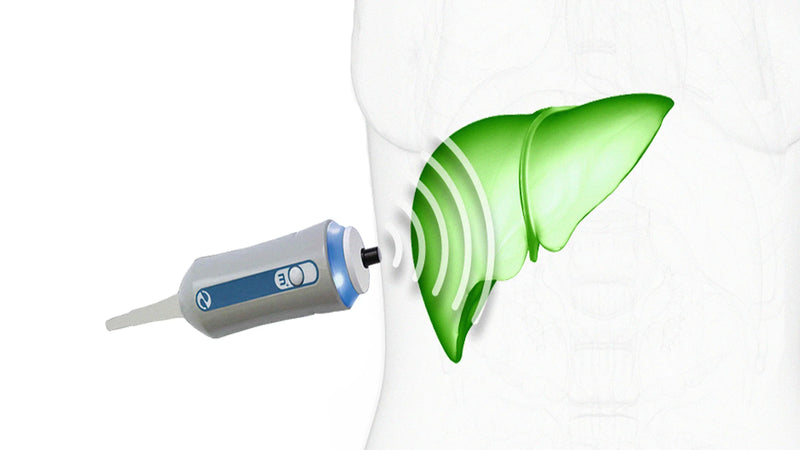 Liver Scan - The Light Center